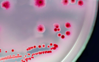 Red bacteria in a petri dish