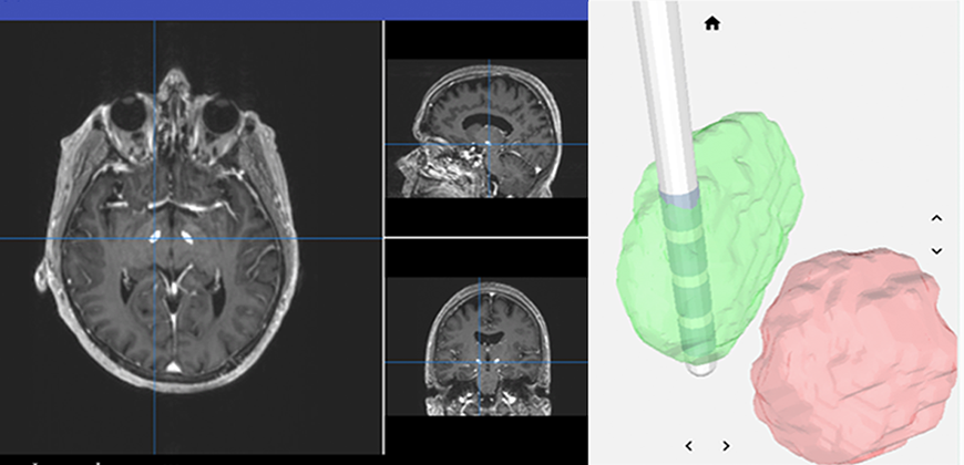 3-D models of the brain