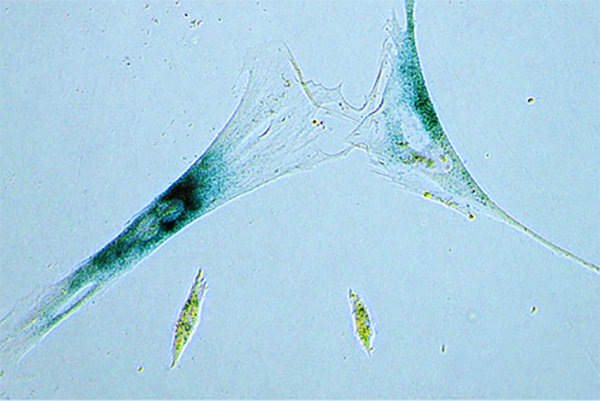 microscope image of senescent cells