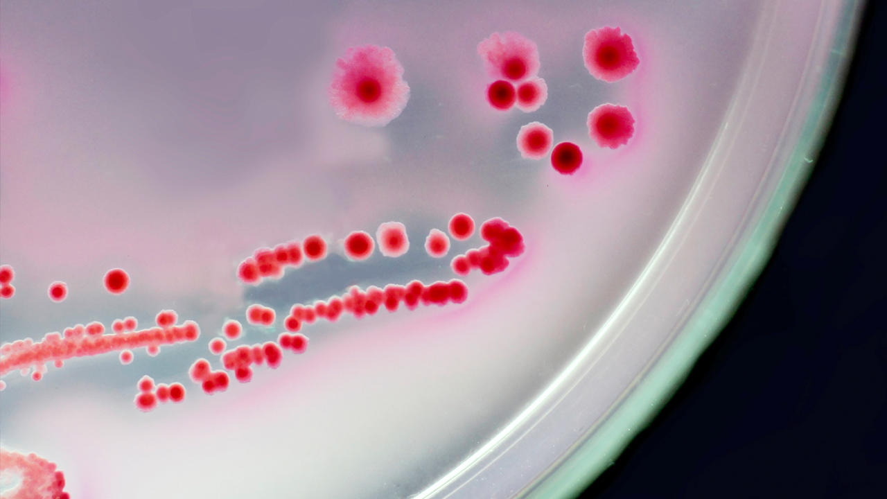Red dots of bacteria inside a petri dish