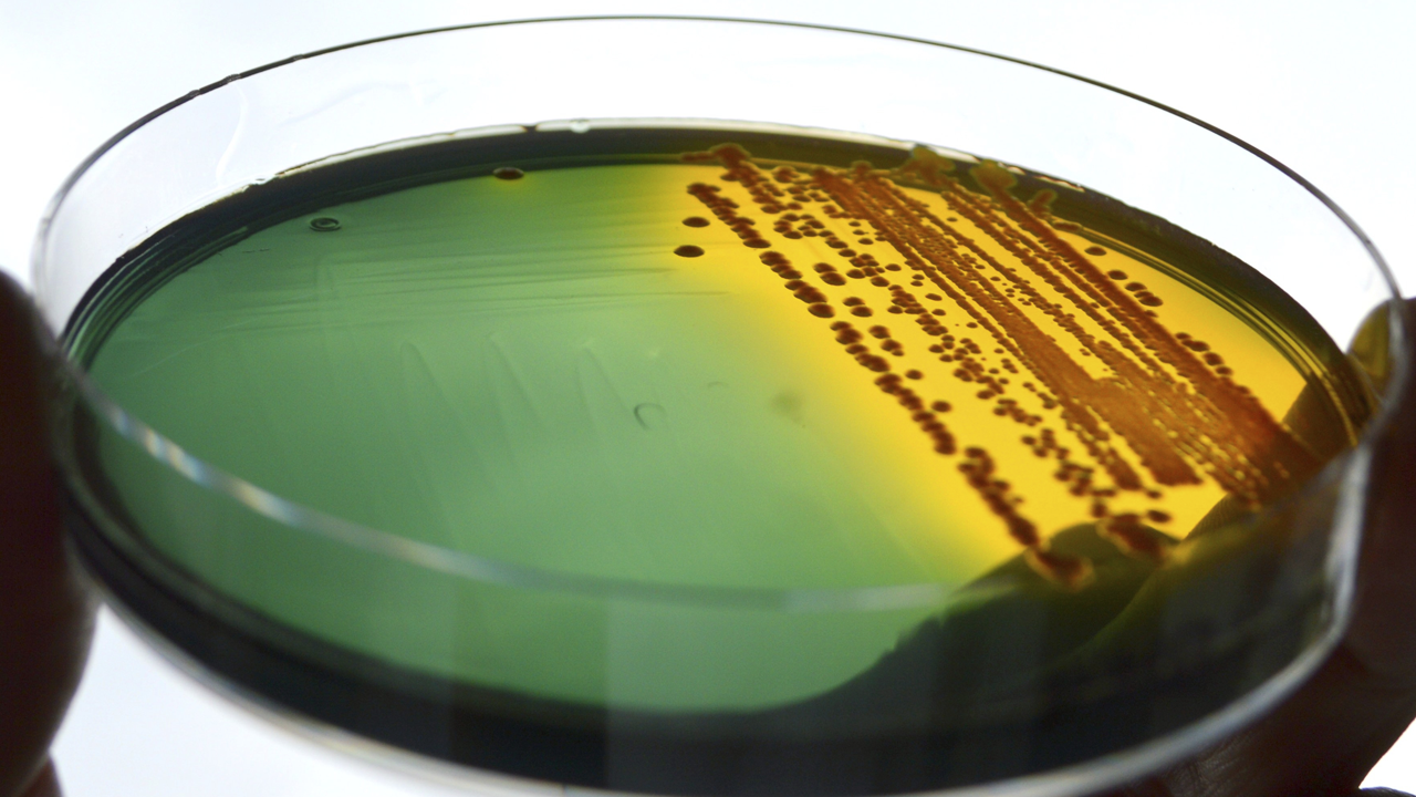 A petri dish with multi-colored liquid inside