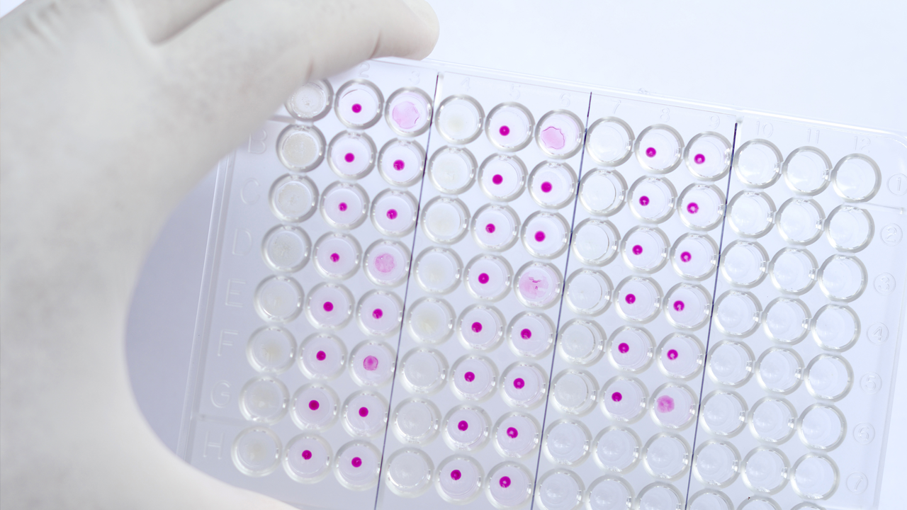 Scientist tests samples for HIV