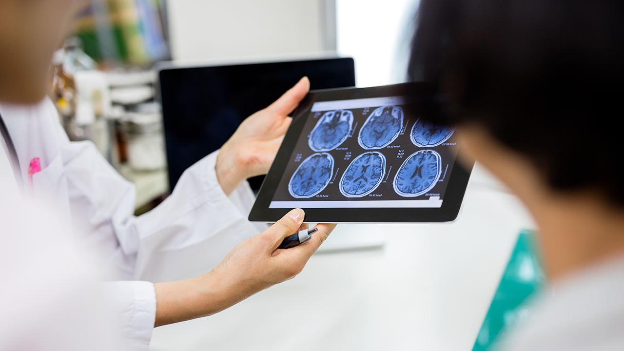 People in lab coats holding a device displaying MRI scans of the brain