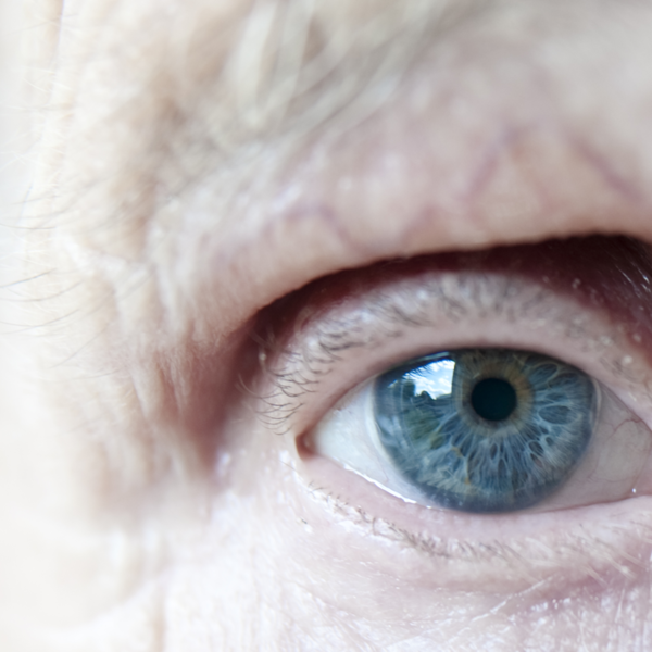 An elderly woman's blue eye