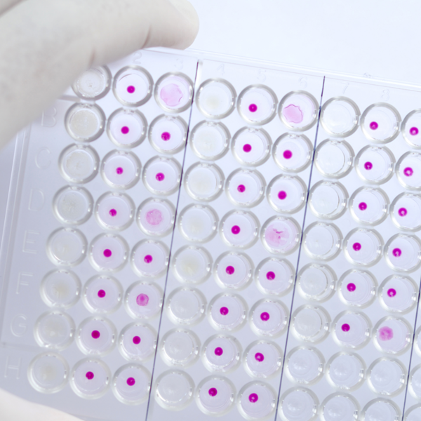 Scientist tests samples for HIV
